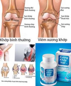 Tác dung của xương khớp việt pro