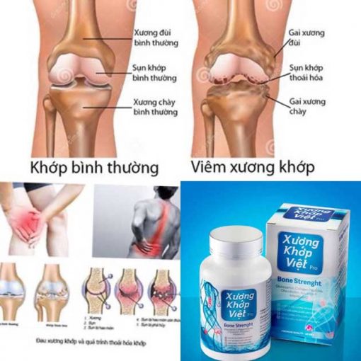 Tác dung của xương khớp việt pro