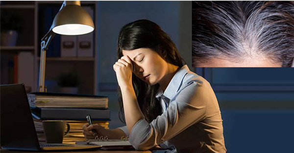 Stress có thể dẫn đến tóc bạc nhanh và sớm 