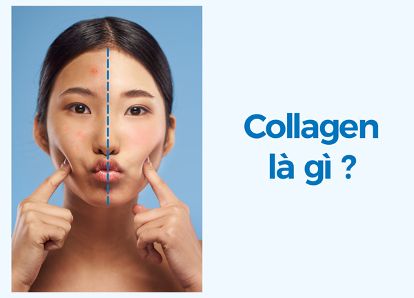 Bạn hiểu collagen là gì? 