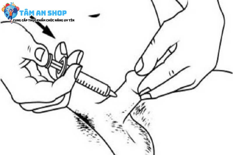 Minh họa hướng dẫn sử dụng thuốc tiêm Alprostadil