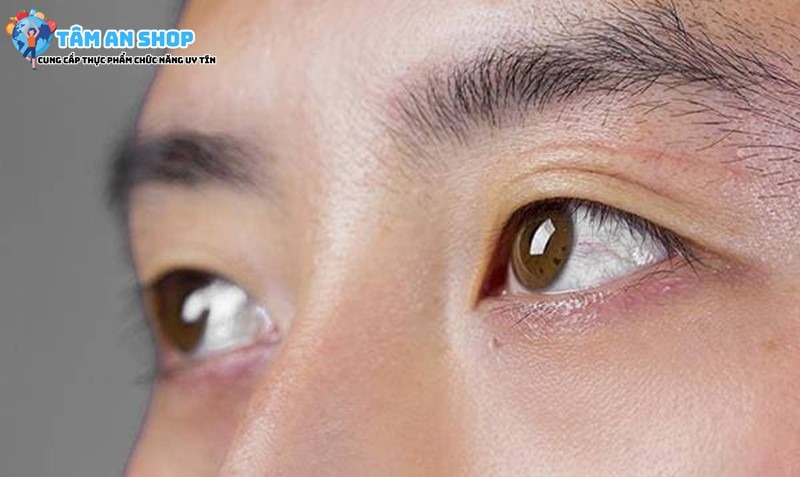 Zeaxanthin ngăn ngừa thoái hóa điểm vàng của mắt