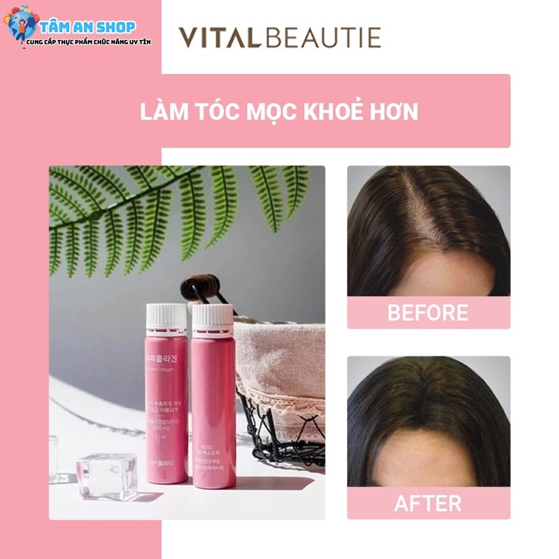 Collagen VB Hàn Quốc 30 ống dành cho người tóc hư tổn