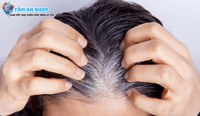 Sản phẩm ngăn ngừa và cải thiện tình trạng tóc bạc