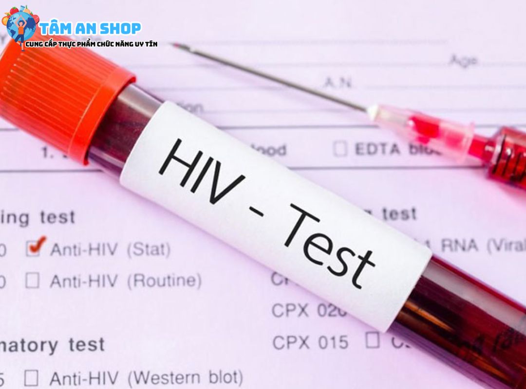 Chi phí xét nghiêm HIV tại Long An