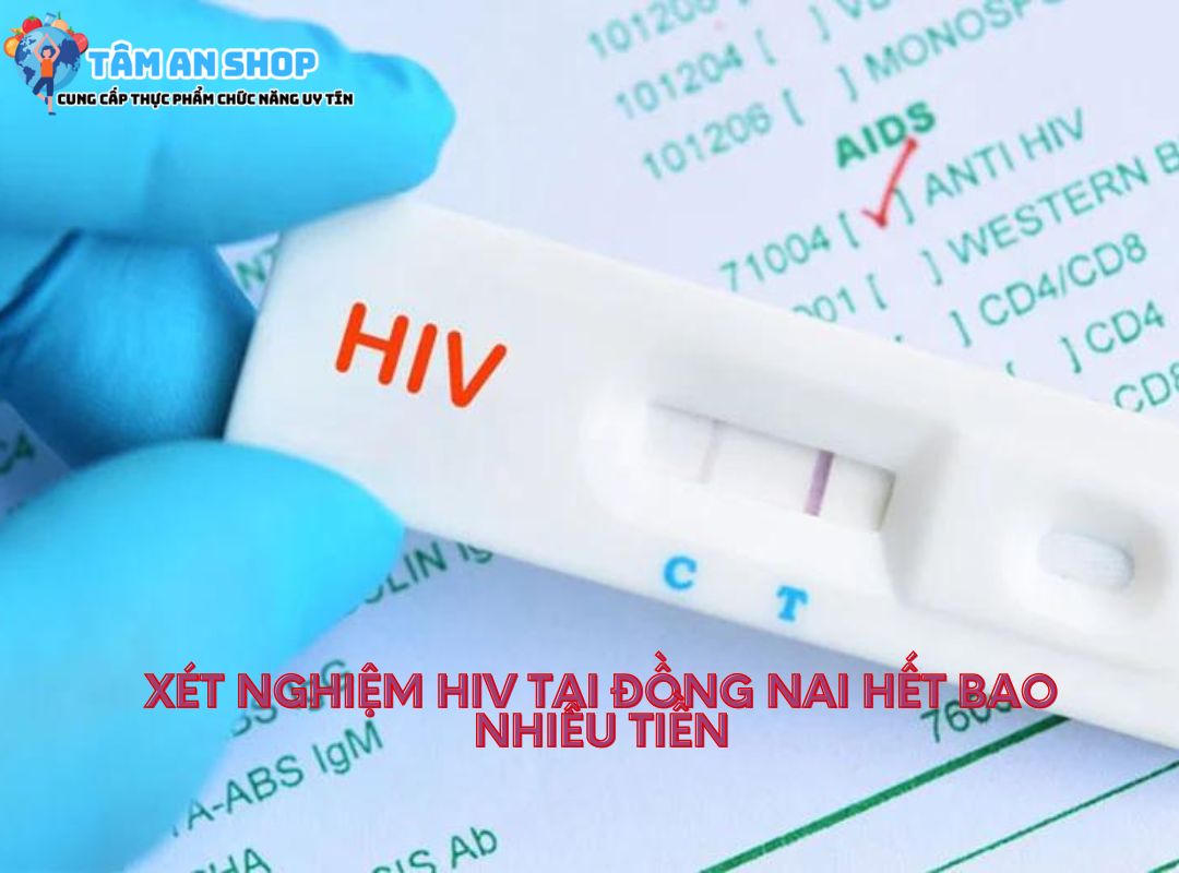 Chi phí xét nghiệm hiv tại đồng nai