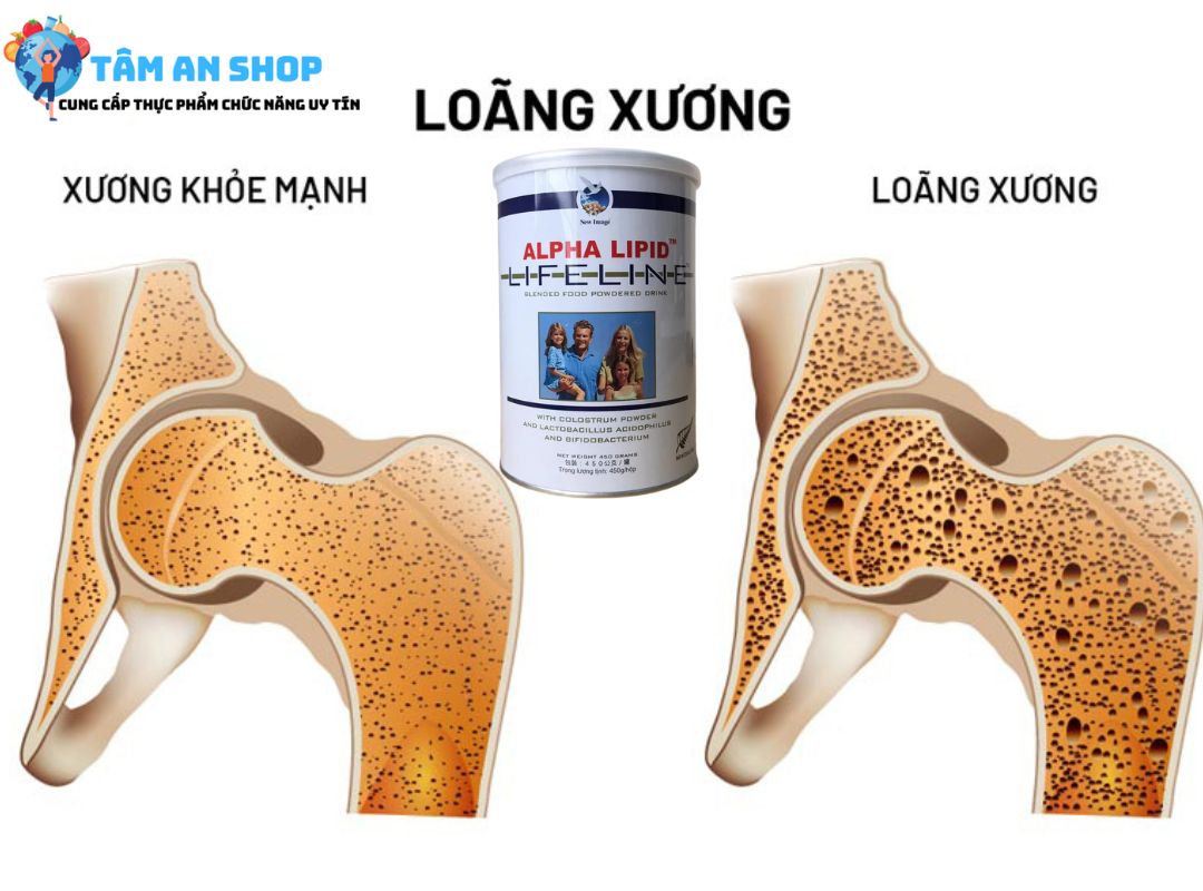 Tác dụng của sữa non alphalipid