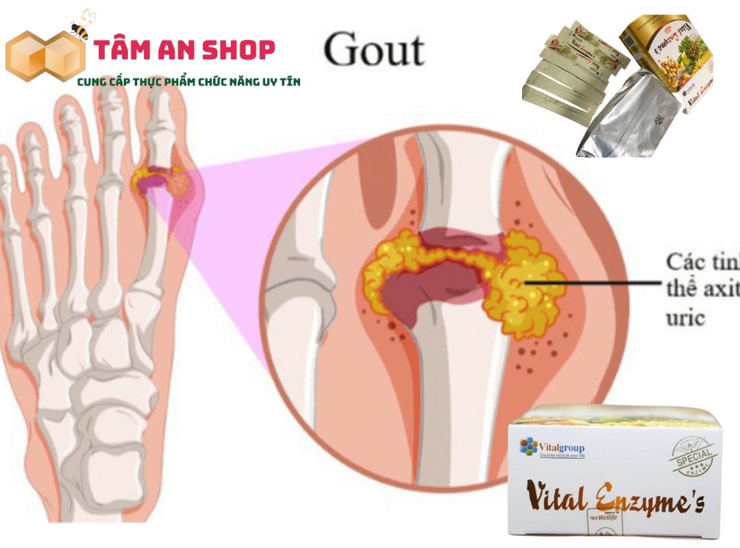 Cách dùng vital enzyme cho người gout